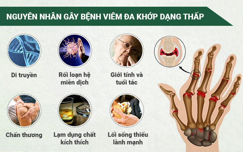 PQA Xuyên Khung Xương Khớp là dược phẩm thảo dược cho người bị viêm khớp dạng thấp, đau nhức xương khớp, cử động khó khăn, các khớp sưng đau hỗ trợ hạn chế đau nhức, giảm các triệu chứng của viêm khớp