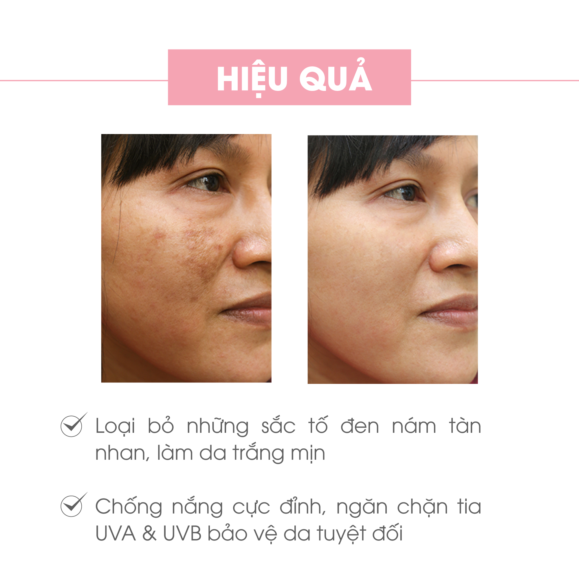 Bộ sản phẩm làm mờ nám da mặt Truesky V04 gồm 1 kem nám da Melasma Cream 15g + 1 gel tẩy tế bào chết Scrub Gel 60ml + 3 miếng mặt nạ trắng da Truesky