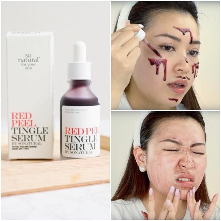 Red Peel Tingle Serum tinh chất tái tạo da sinh học mờ thâm trắng da So Natural 35ml