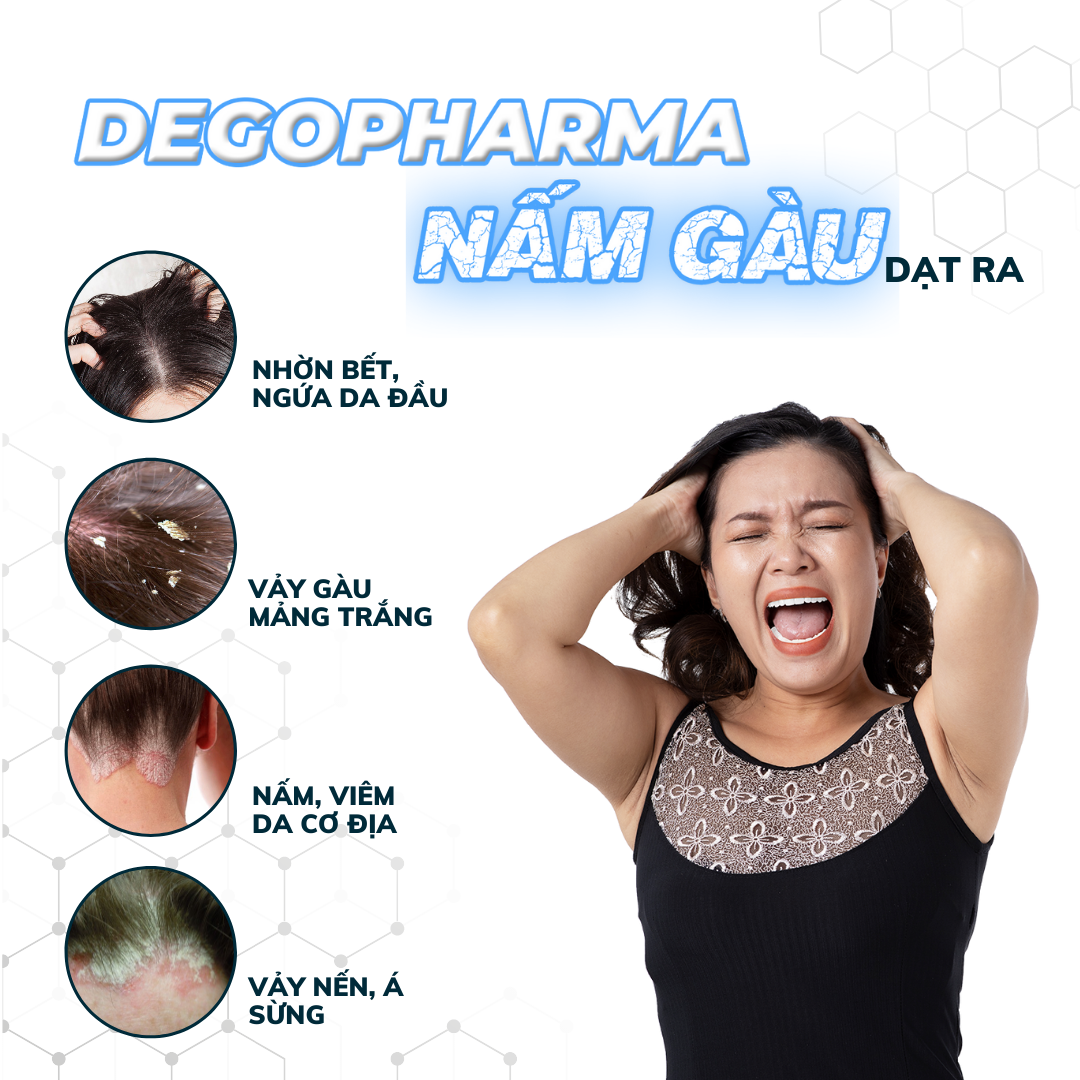 Dego Pharma - Dầu gội sạch vảy gàu mảng trắng, hết ngứa chiết xuất thiên nhiên từ vỏ cây Zizyphus, sản xuất theo tiêu chuẩn và dưới sự giám sát của công ty dược phẩm Châu Âu (80ml)