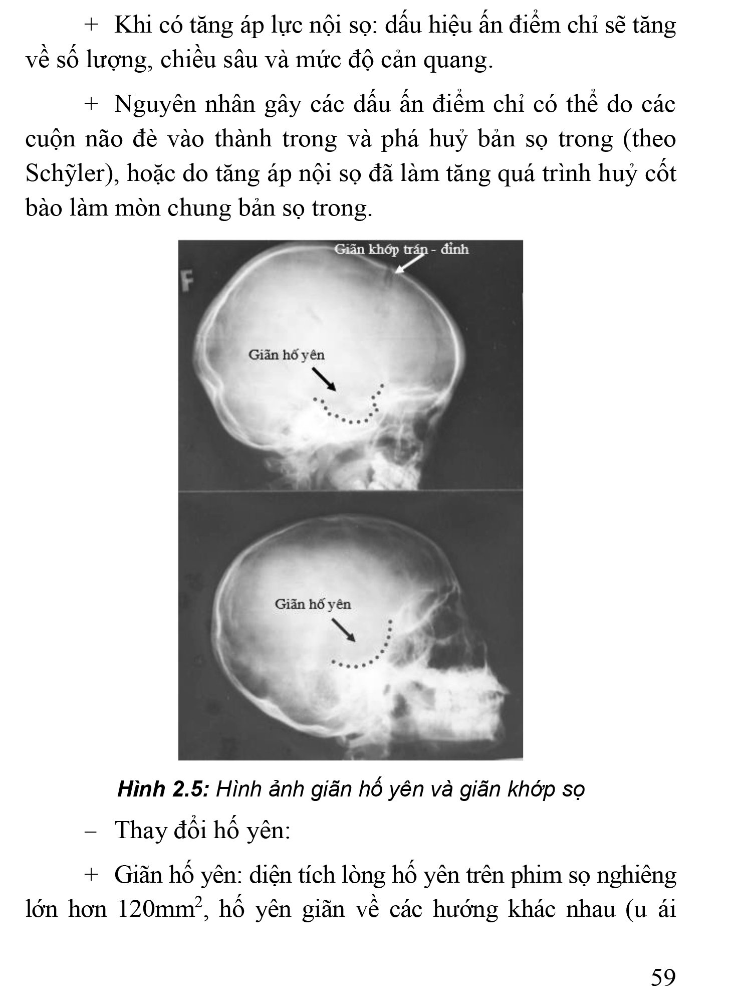 Thực Hành Lâm Sàng Thần Kinh Học - Tập 4: Chẩn Đoán Cận Lâm Sàng