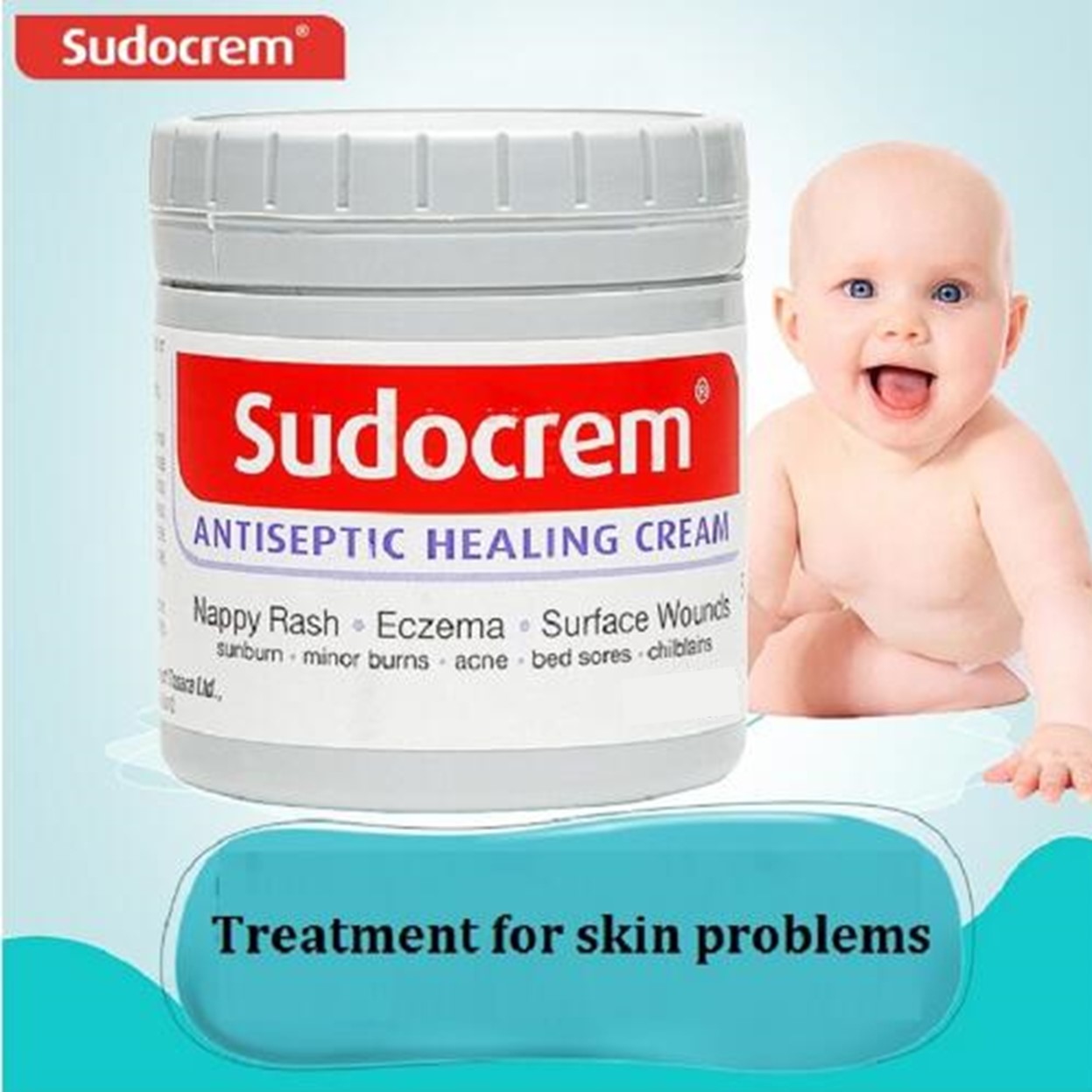 Kem chống hăm đa năng Sudocrem 60g