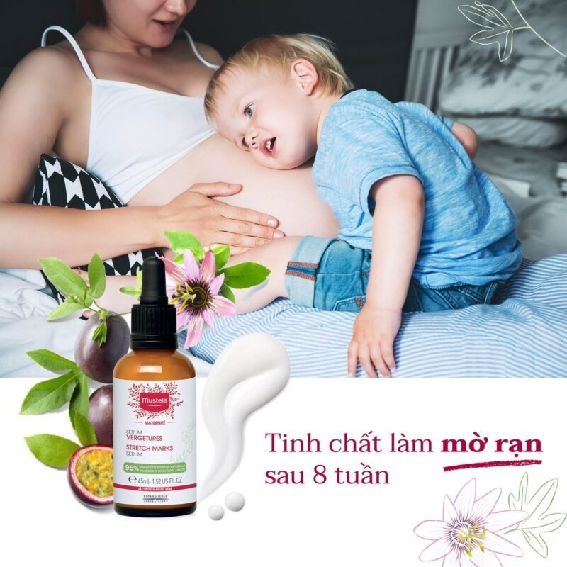 Tinh Chất Làm Mờ Vết Rạn Da Cho Mẹ Bầu Mustela STRETCH MARKS SERUM 45ML