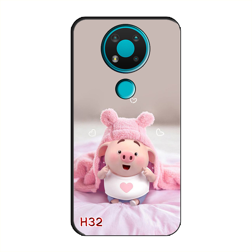 Ốp Dẻo Dành Cho NOKIA 3.4