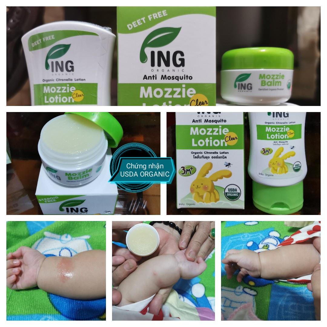 ING Organic After Balm - Kem Hữu Cơ Thoa Vết Muỗi Và Côn Trùng Đốt - Không Ngứa - Không Sưng Đỏ - Không Sẹo Thâm