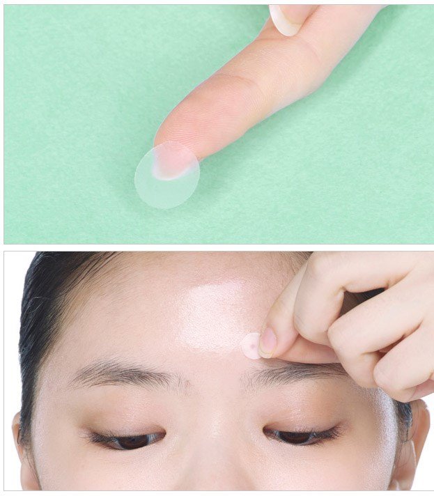 Miếng Dán Mụn, Ngăn Ngừa Sẹo Somaderm Thin