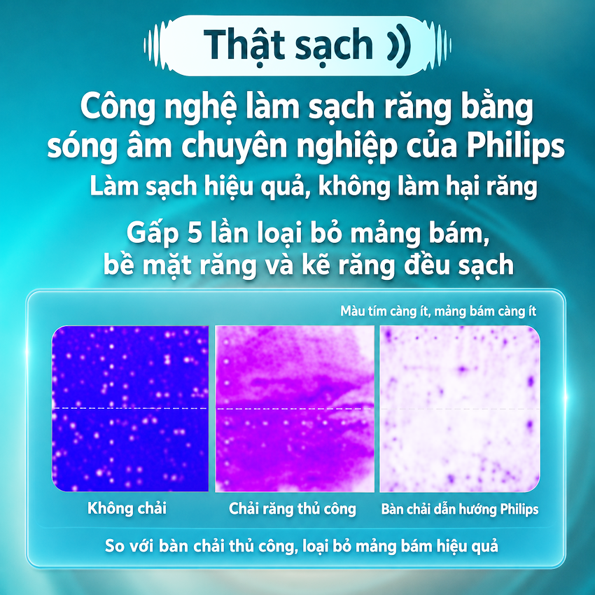 Bàn chải đánh răng điện thương hiệu Hà Lan cao cấp Philips HX5681 Sonicare Electric Toothbrush Serial 5800 - Hàng nhập khẩu