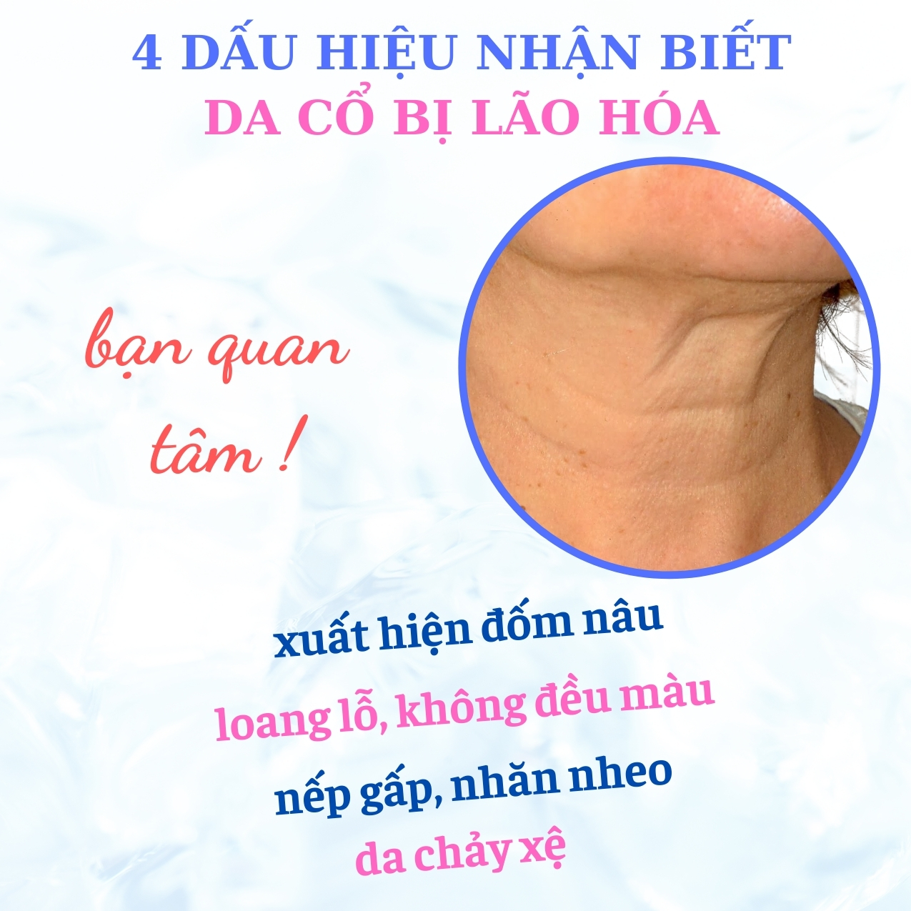 [MỸ PHẨM NHẬT BẢN] Kem Dưỡng Da Cổ Nhật Bản MICCOSMO Hurry Harry 40g, Chiết Xuất Nhau Thai, Dưỡng Trắng, Chống Nhăn, Ngăn Ngừa Lão Hóa, Căng Bóng, Trẻ Hóa Da (HH01)