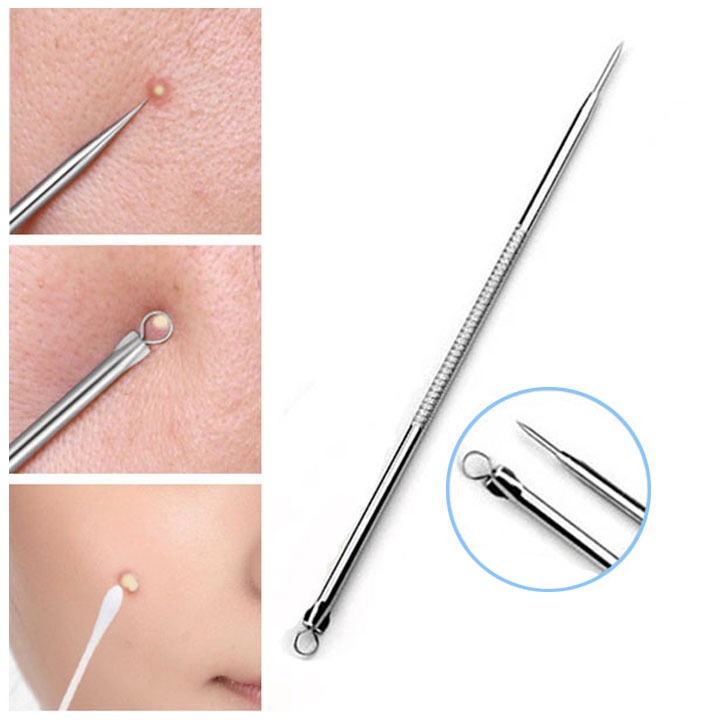 Cây nặn mụn - nặn mụn đầu đen và các loại mụn 2 đầu