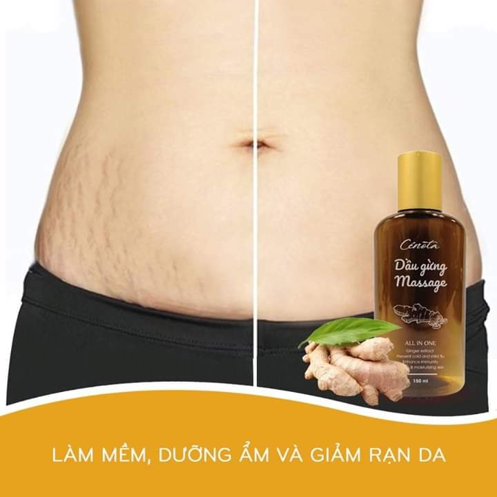 Dầu gừng Massage Cenota 150ml Giảm đau Chống Cảm