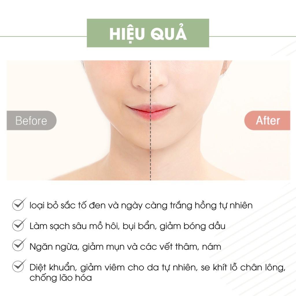 Sữa rửa mặt trắng da, ngừa mụn, chiết suất từ tinh chất trà xanh 120ml - Giúp giữ ẩm , ngừa mụn và dưỡng trắng hiệu quả.