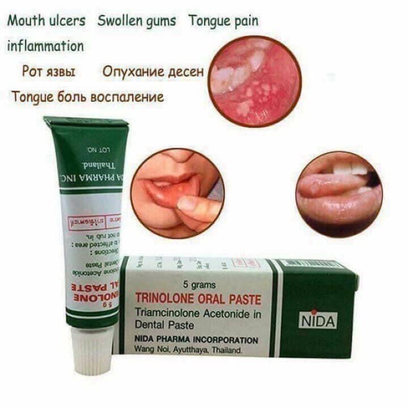 Kem nhiệt miệng Trinolone Oral Paste Thái Lan 5g