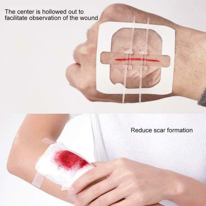 Zipper Band-aid Outdoor No-sewing Quick Wound Dressing Suture Tape Bandage Suture-free Zip Band-aids first aid Hemostasis Tool