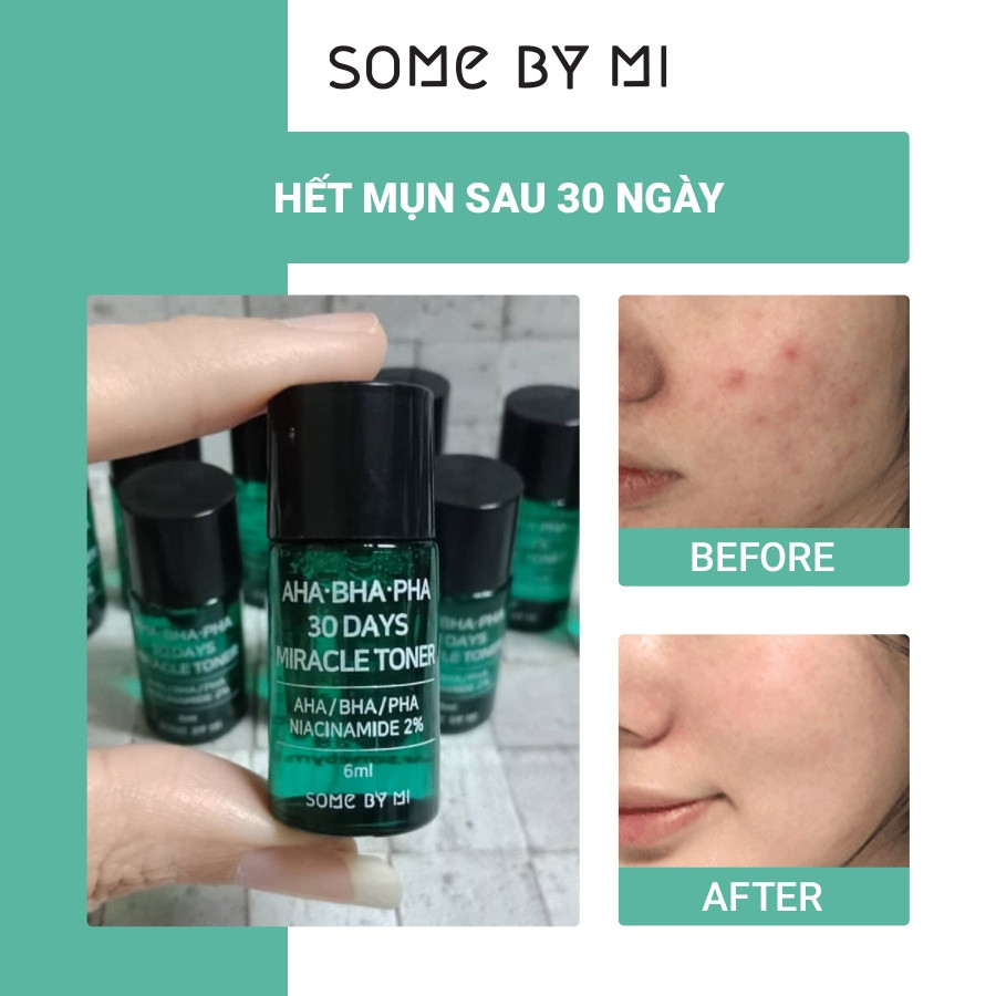 Minisize Nước Hoa Hồng SOME BY MI Hỗ Trợ Trị Mụn Thần Kỳ 6ML