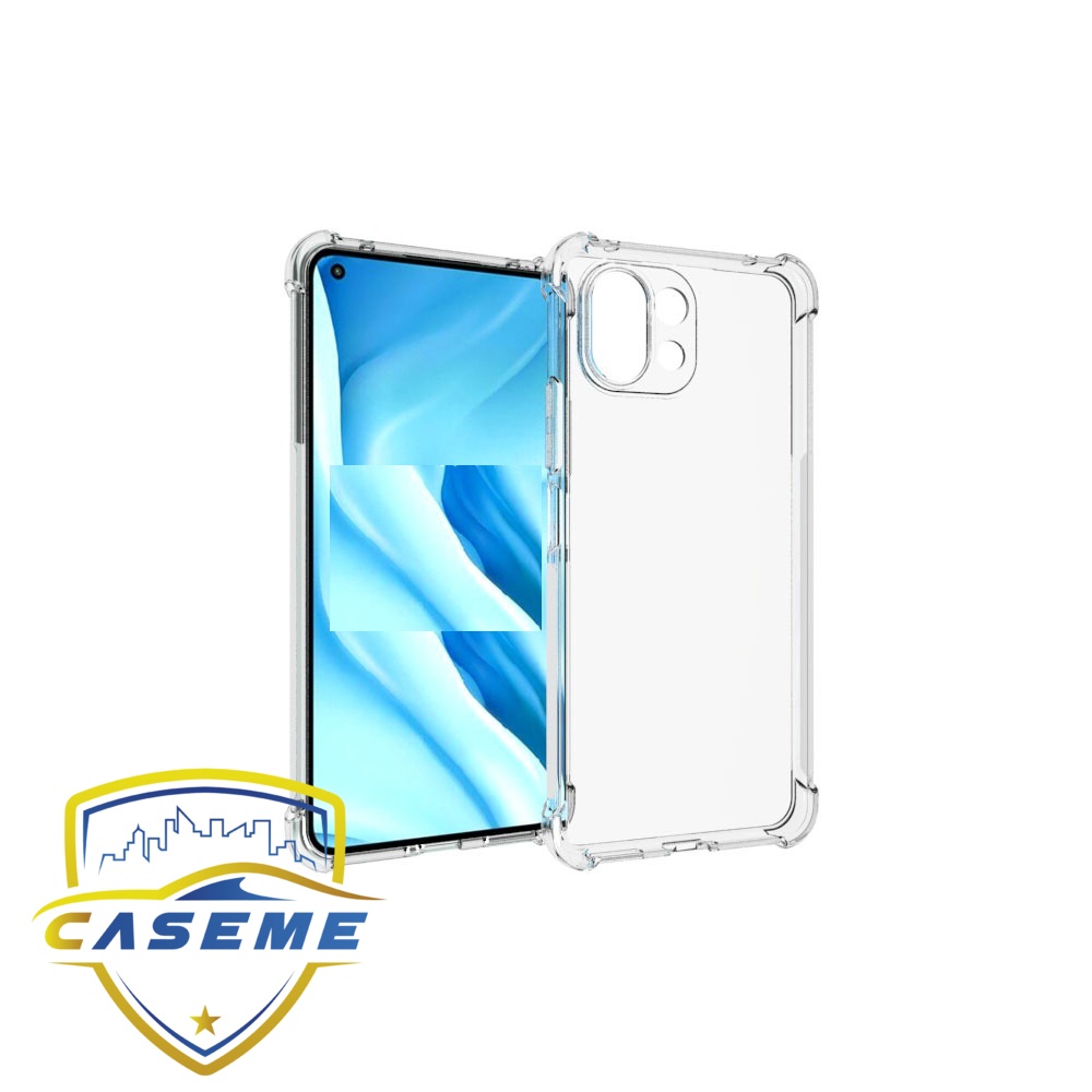 Ốp lưng dành cho Xiaomi Mi 11 Pro dẻo trong chống sốc