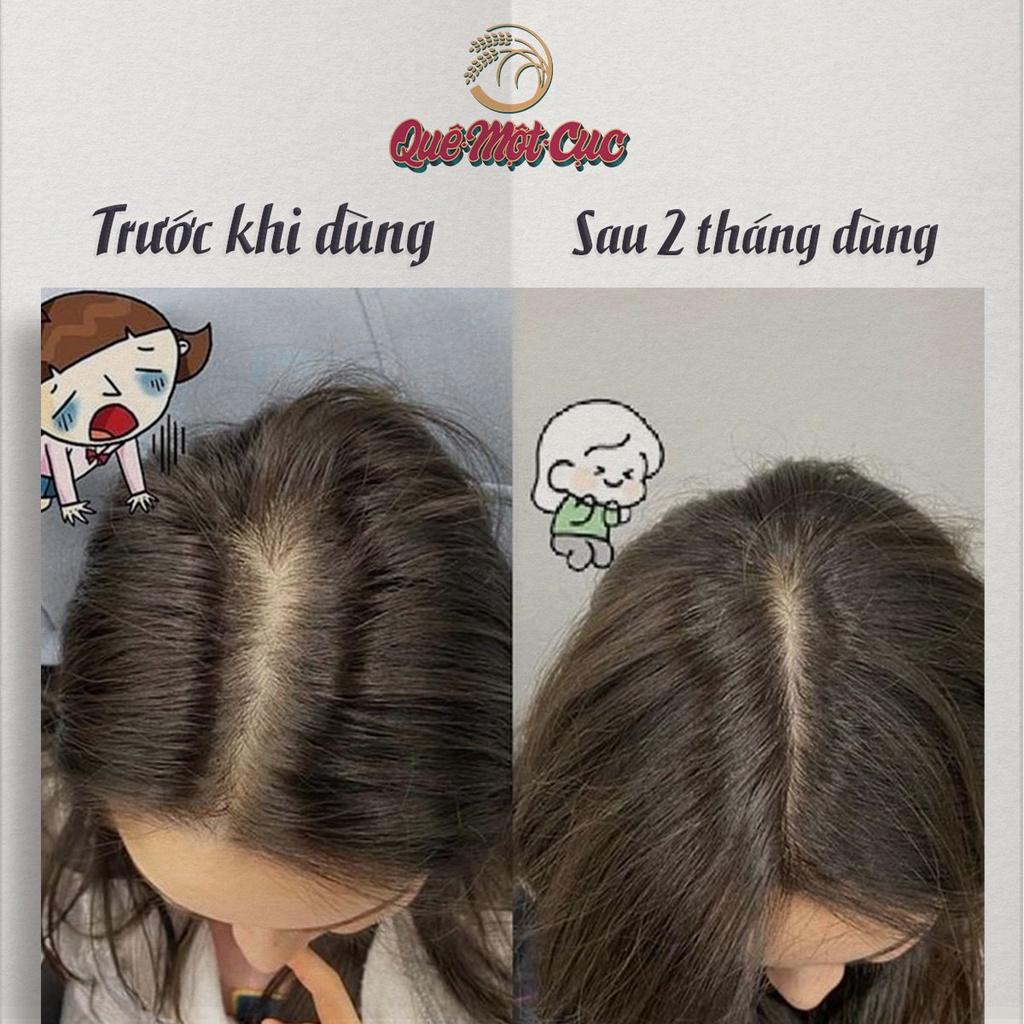 Tinh dầu bưởi mọc tóc siêu đậm đặc, chuyên kích mọc tóc con, làm dày, giảm rụng QUÊ MỘT CỤC 10ml