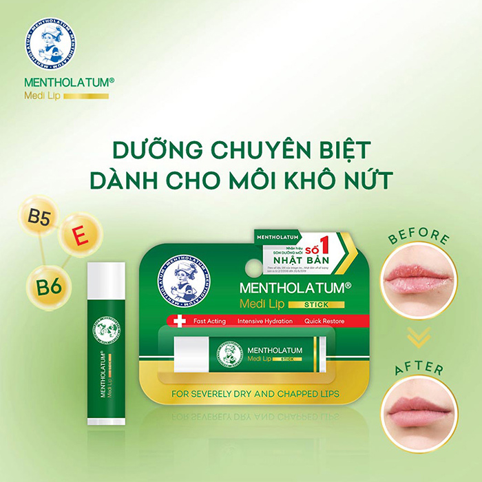 Son dưỡng môi chuyên biệt dành cho môi khô, nứt nẻ Mentholatum Medi Lip Stick 4.3g