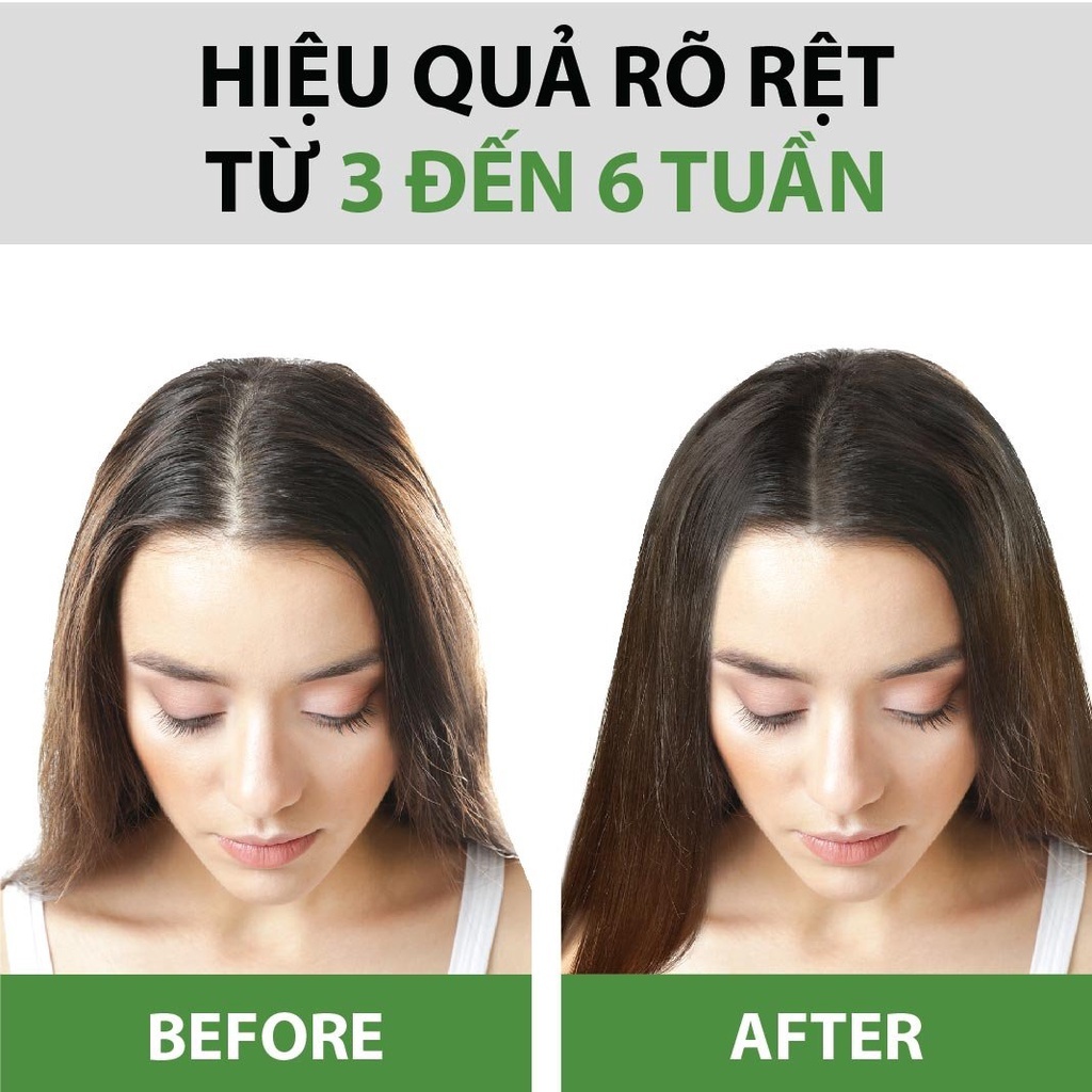 Combo Minisize Dầu Gội & Dầu Xả Bưởi Ngừa Rụng & Kích Thích Mọc Tóc Từ Tinh Dầu Bưởi Nguyên Chất MILAGANICS