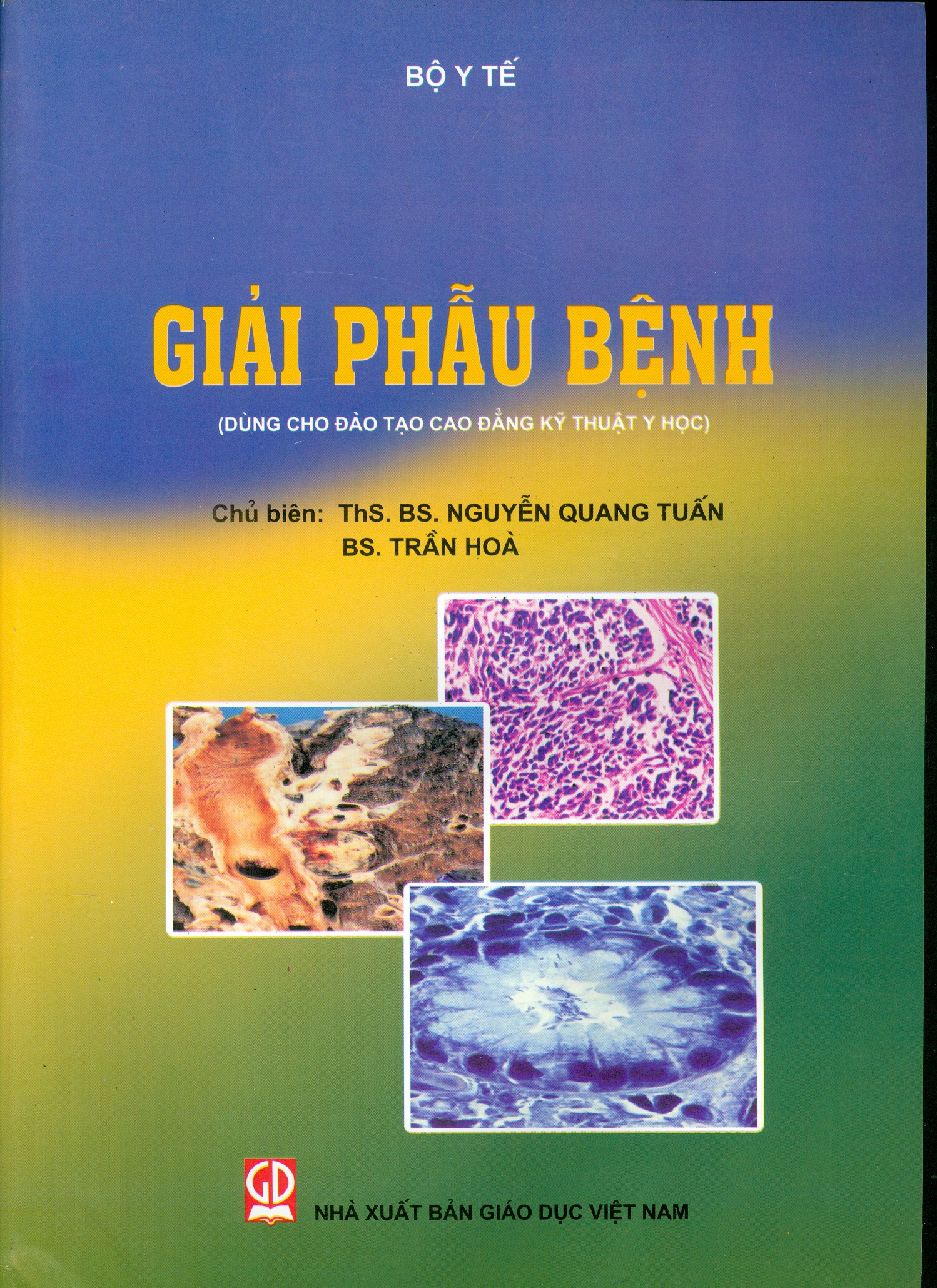 Giải Phẫu Bệnh (Dùng cho đào tạo cao đẳng kỹ thuật y học)