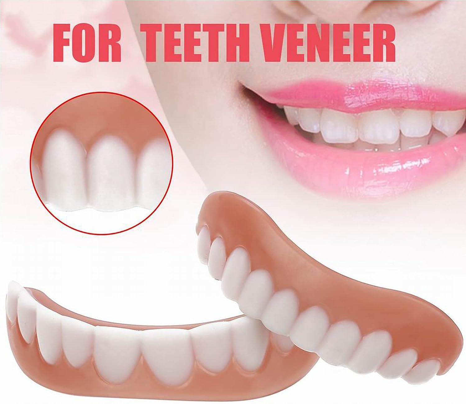 Răng giả Veneer tức thì Thoải mái Nụ cười phía trên Răng trắng Răng thẩm mỹ Răng giả tạm thời Bộ dụng cụ trám răng linh hoạt để che đi những chiếc răng bị mất