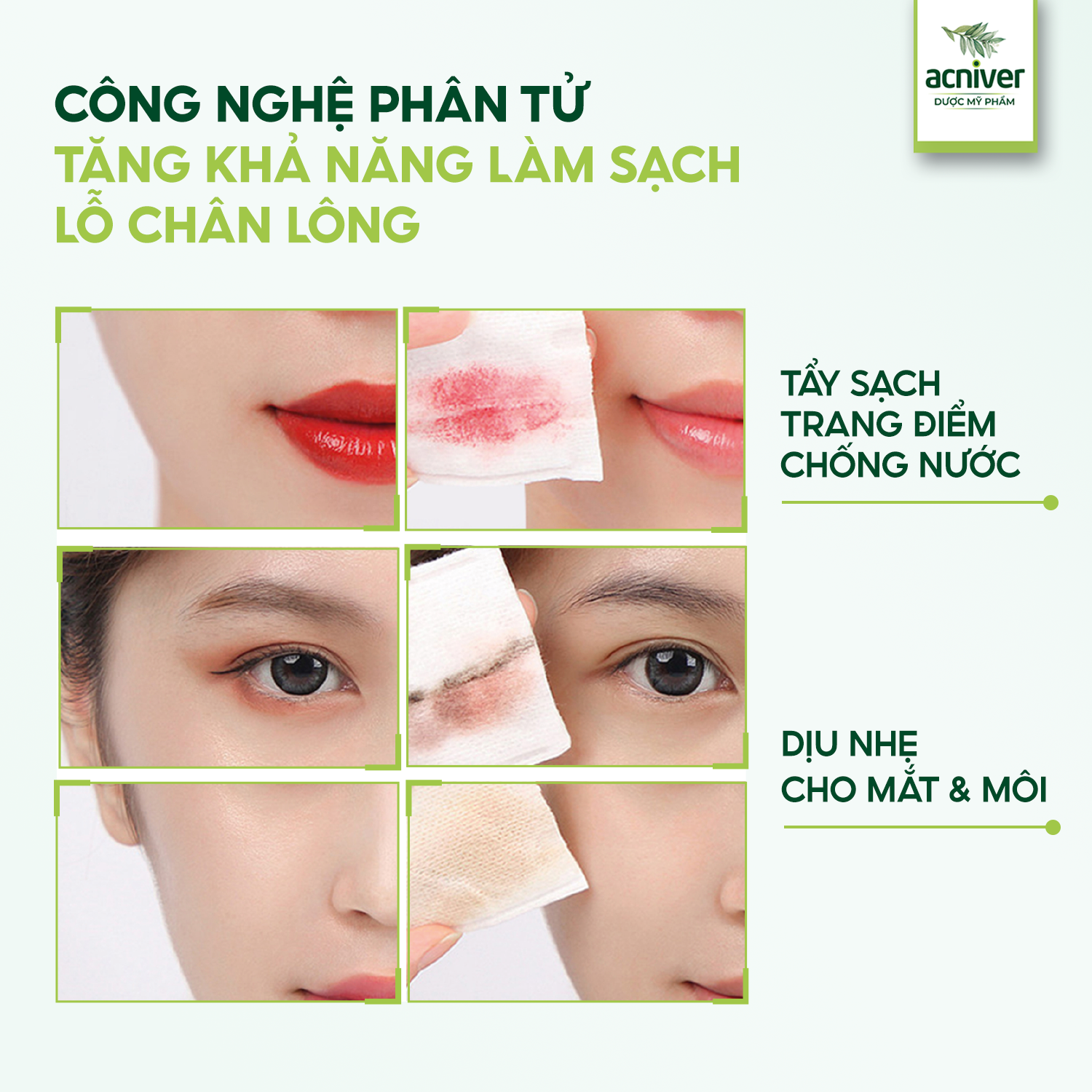 Nước Tẩy Trang Acniver Chiết Xuất Thành Phần Tự Nhiên Giúp Làm Sạch Da, Loại Bỏ Bụi Bẩn, bã Nhờn, Lớp Trang Điểm Tế Bào Da Chết, Làm Thoáng Lỗ Chân Lông, Duy Trì Độ Âm Tự Nhiên Chai 150ml