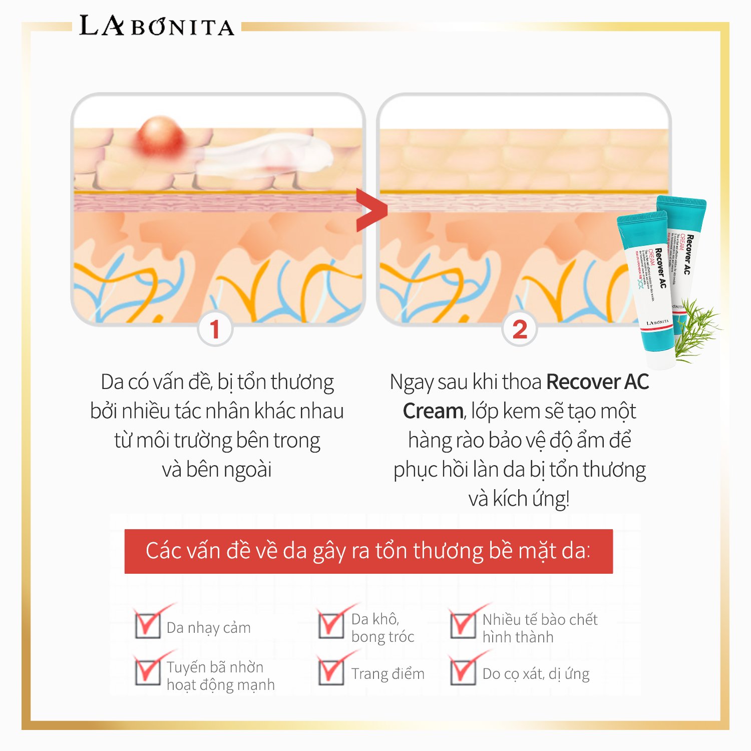 Kem giảm mụn dưỡng da phục hồi – LaBonita Recover AC Cream 50ml