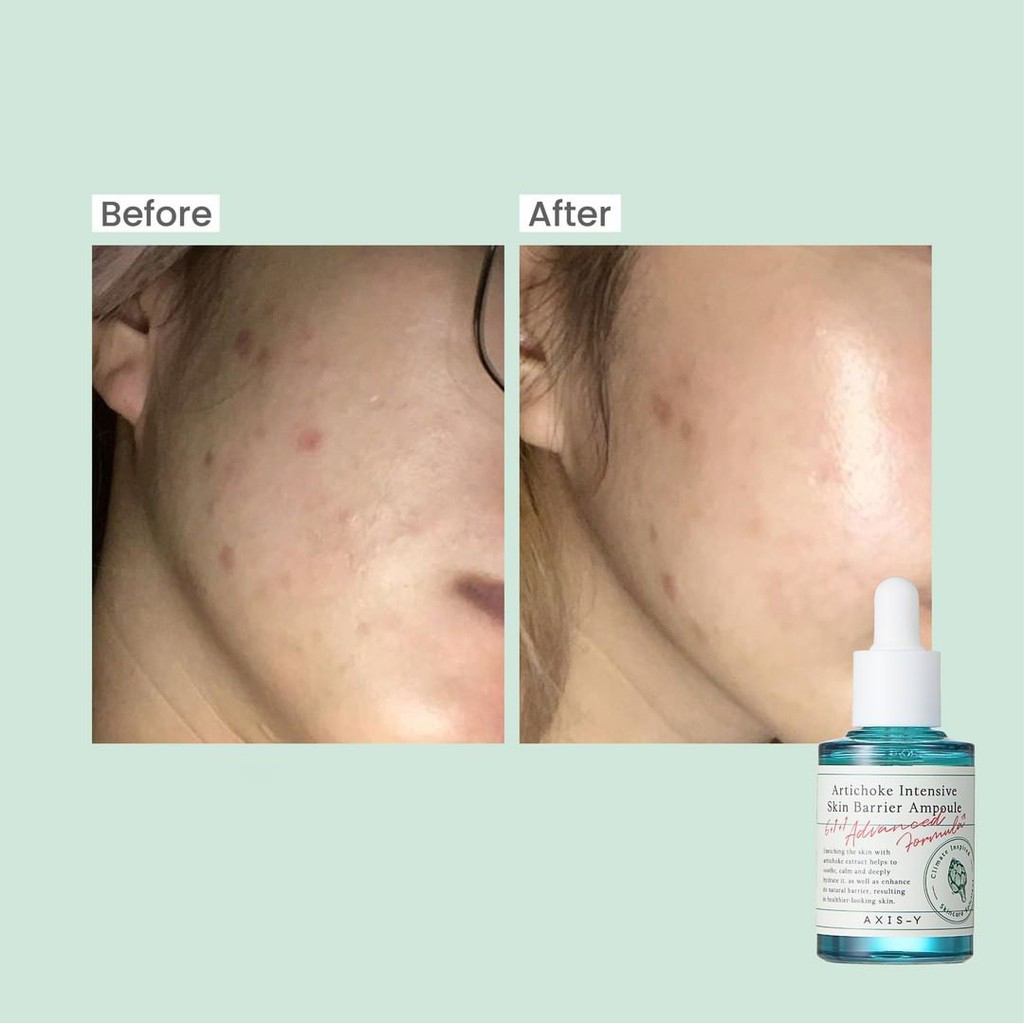 Serum dưỡng ẩm và phục hồi da AXIS-Y Artichoke Intensive Skin Barrier Ampoule 30ml