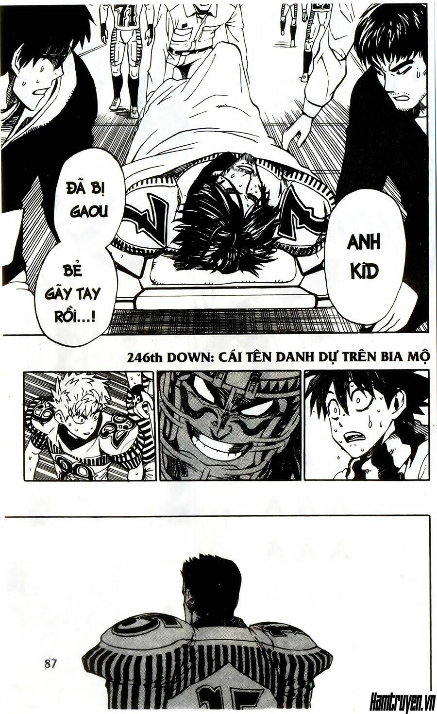 lá chắn mắt chapter 246 2