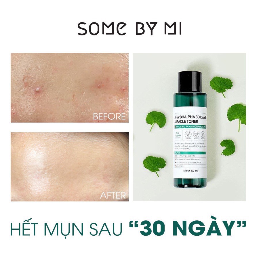 Nước hoa hồng Some By Mi AHA- BHA- PHA 30 Days Miracle Toner 150ml