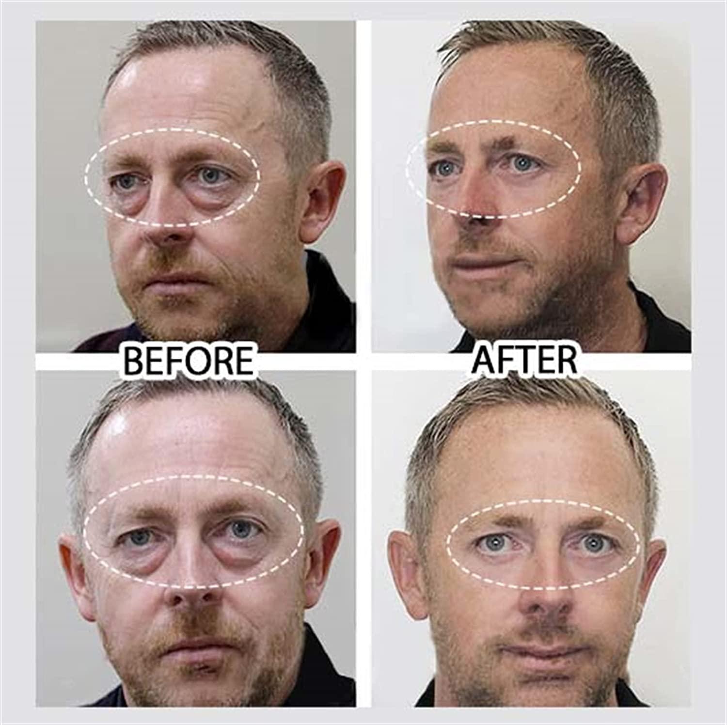 Kem dưỡng ẩm cho nam giới, giảm sưng, quầng thâm, túi nước mắt, nếp nhăn và nếp nhăn quanh mắt