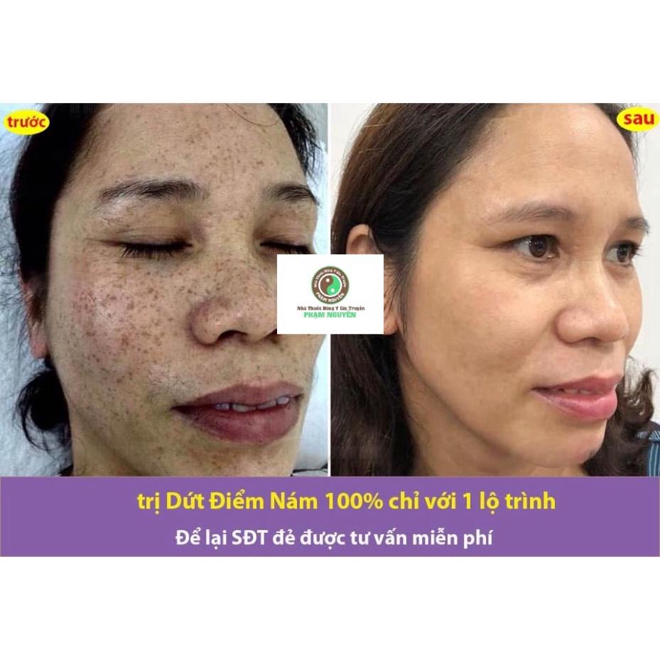 Bộ kem dưỡng trăng, giảm nám tàn nhang và serum cốt sâm đông y gia truyền phạm nguyễn