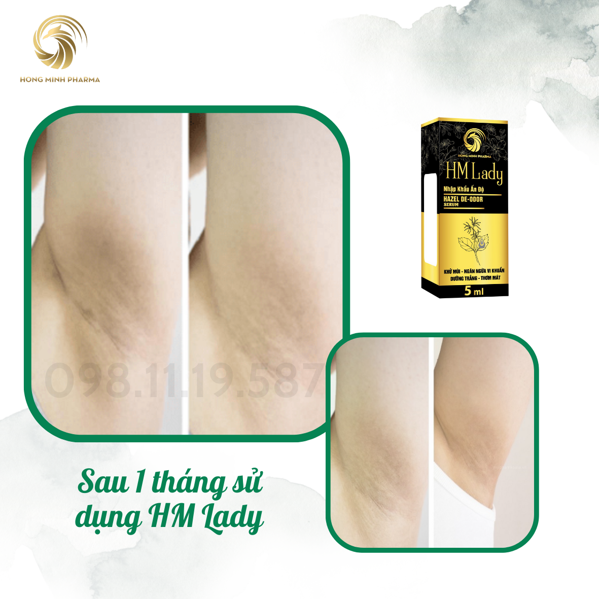 Serum Khử Mùi HM Lady Chính Hãng - Khử Hôi Nách, Hôi Chân, Làm Sáng Vùng Da Nách Bẹn