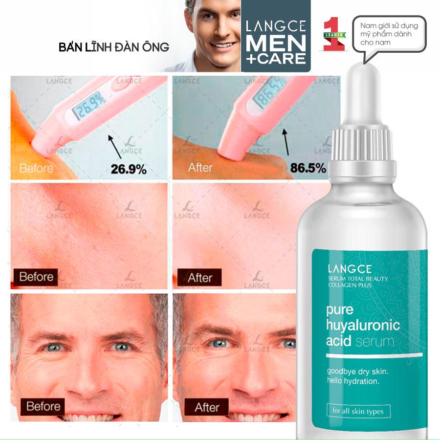 TOTAL BEAUTY SERUM COLLAGEN+ HYALURONIC ACID THẦN DƯỢC DƯỠNG DA 100ml LANGCE DÀNH CHO NAM