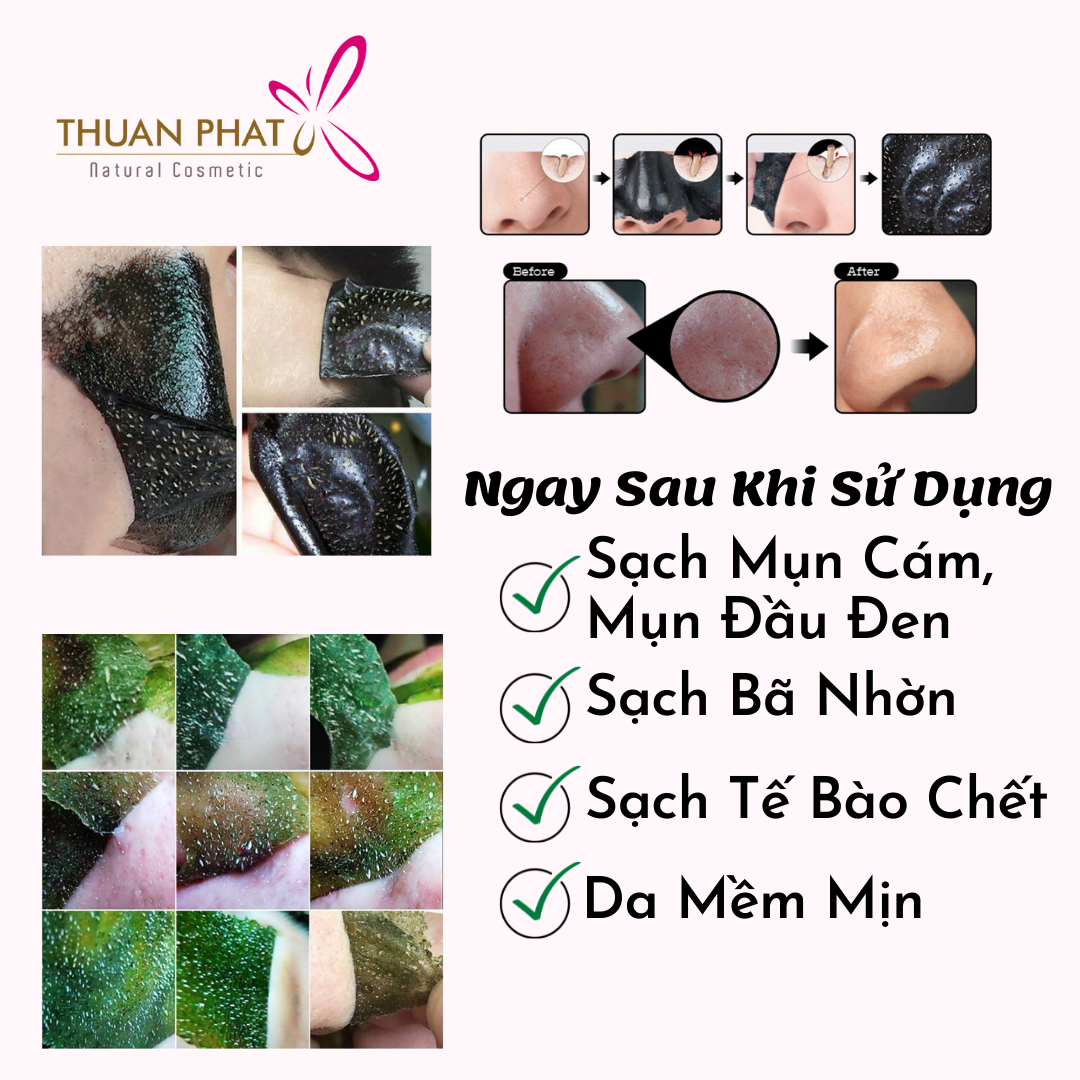 Gel lột mụn hút sạch mụn cám, mụn đầu đen YOSHI 60gr