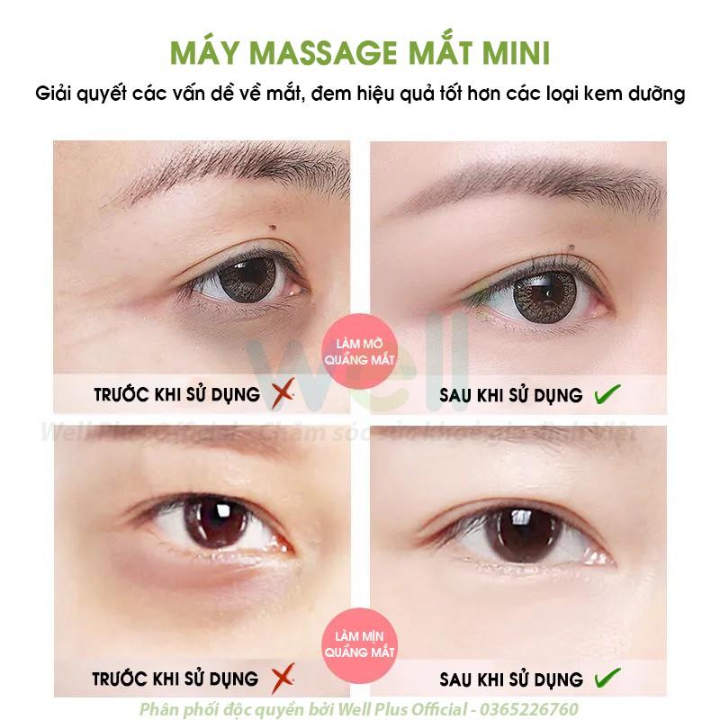 Máy Massage Mắt Mini Cao Cấp, Máy Mát Xa Mắt Làm Giảm Nếp Nhăn Quầng Thâm, Bọng Mắt Thế Hệ Mới