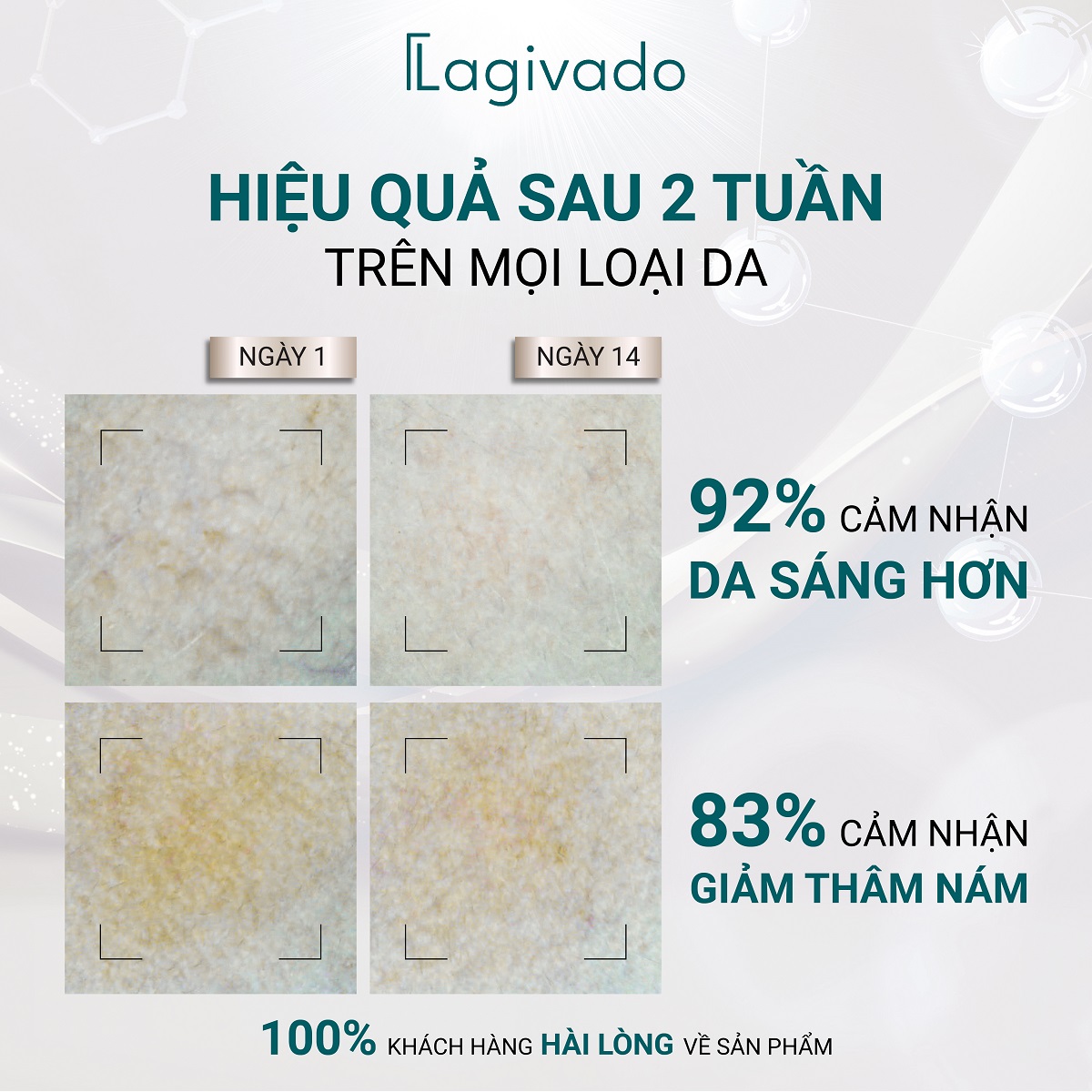 Kem dưỡng mờ thâm nám, đốm nâu Lagivado High-L Revital Cream với Fragaria vesca 51,4% - 50 g