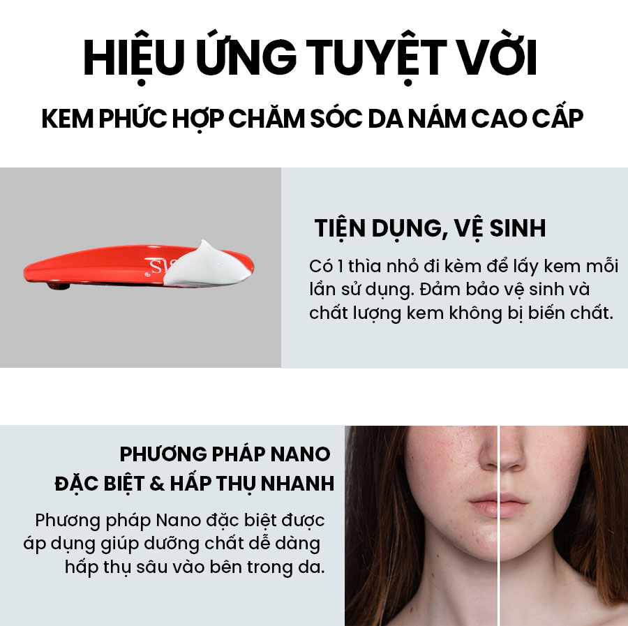 Kem phức hợp chăm sóc da nám cao cấp WHISIS Premium MELASMA Care Complex Cream 50g