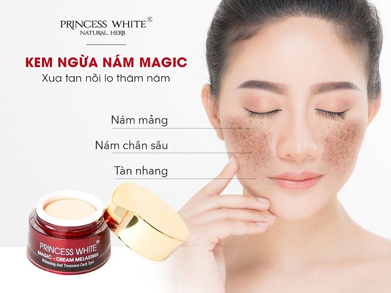 Kem Mờ Nám Tàn Nhang Princess White Magic Cream Melassma 20g