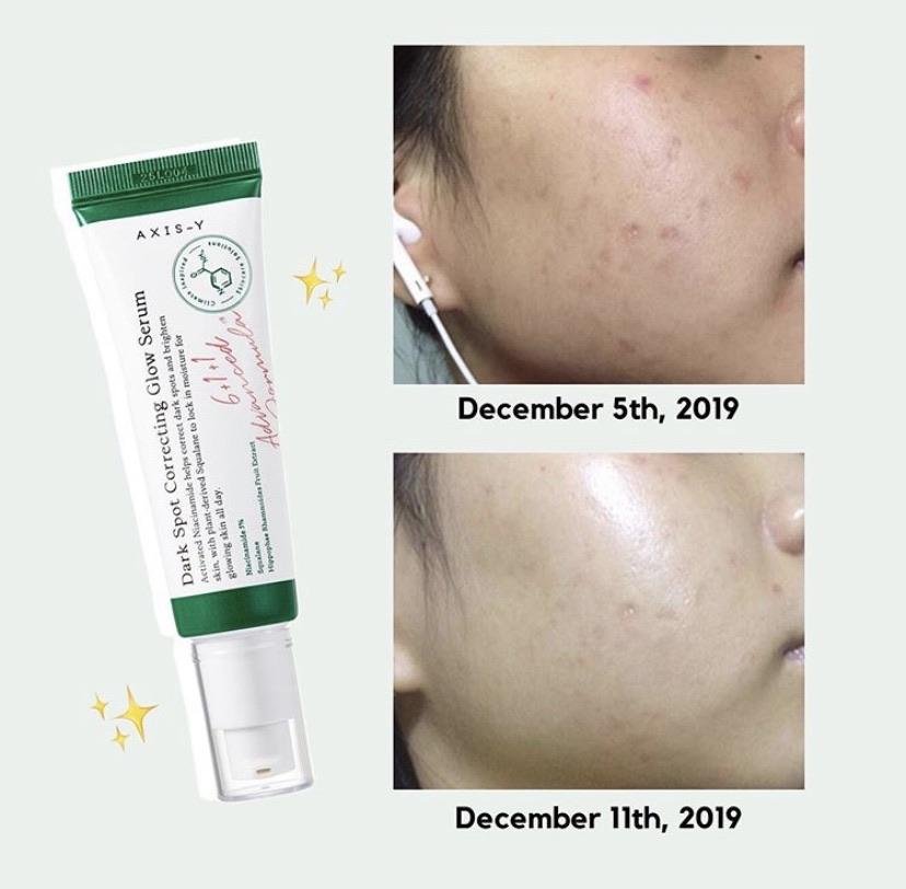Tinh Chất 5% Niacinamide Cải Thiện Da Không Đều Màu, Mờ Thâm Axis-Y Dark Spot Correcting Glow Serum 50ml