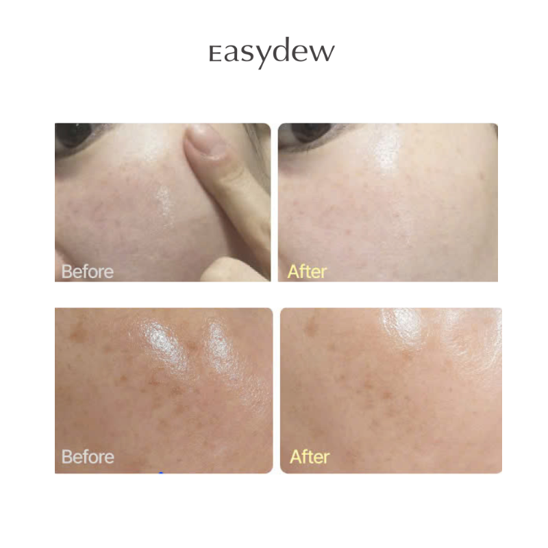 Easydew DW-EGF Retinol 0.03% MELATONING CREAM 30ml (Basic)