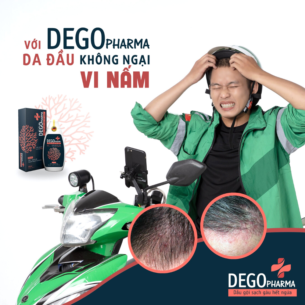 Combo 2 dầu gội sạch gàu hết ngứa Dego Pharma chiết xuất hoàn toàn từ thiên nhiên cải thiện tình trạng vảy nấm (80ml)