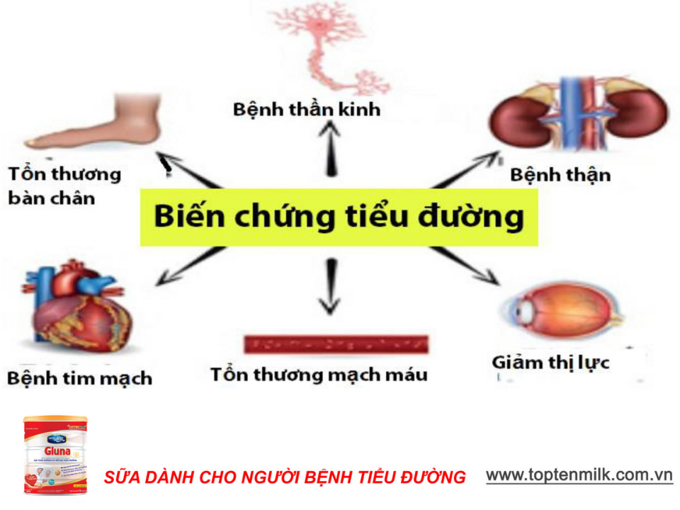 Sữa tiểu đường gluna 400g TOPTEN Milk