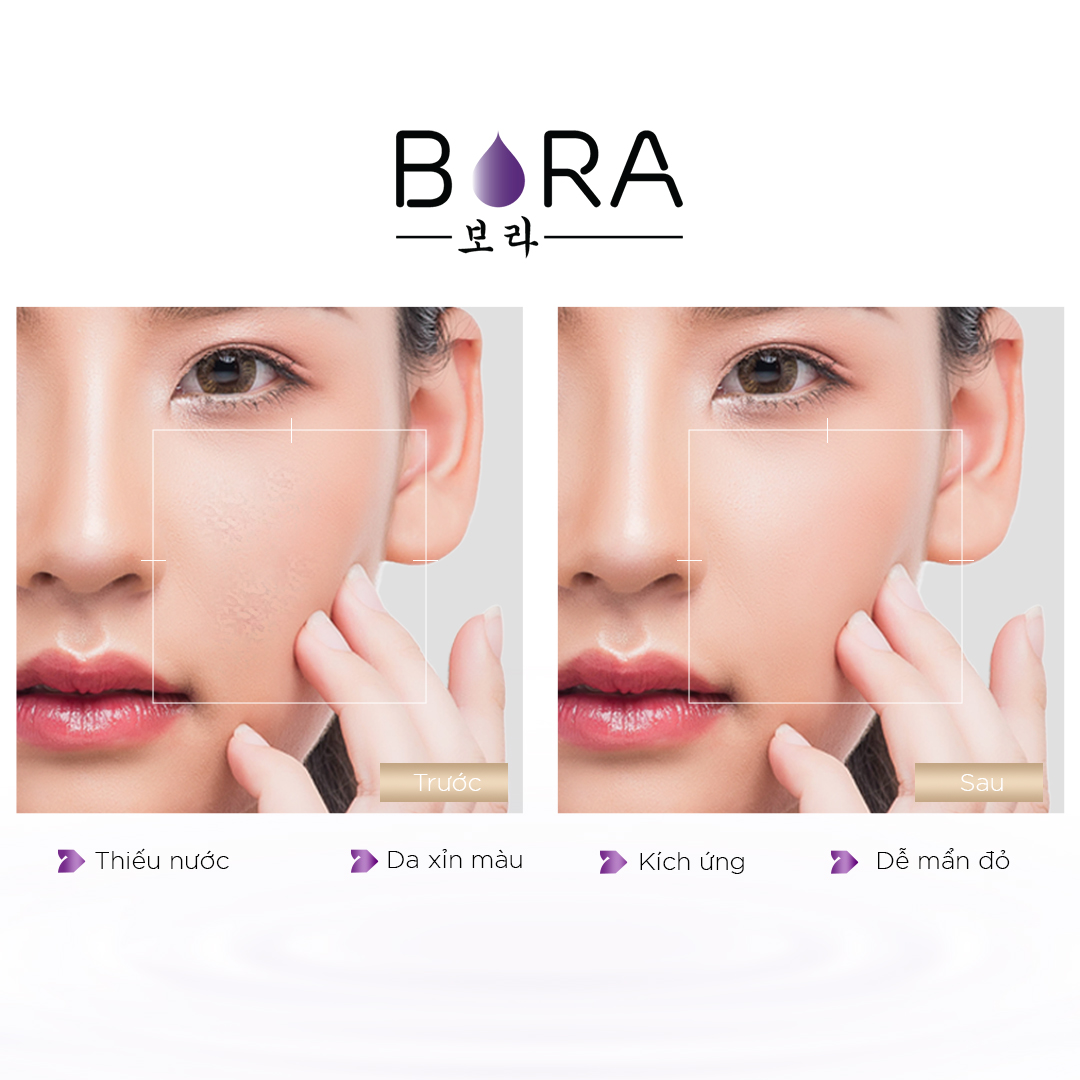 Tinh chất dưỡng ẩm nuôi dưỡng làn da trắng hồng Bora HA B5 Serum lọ 30ml