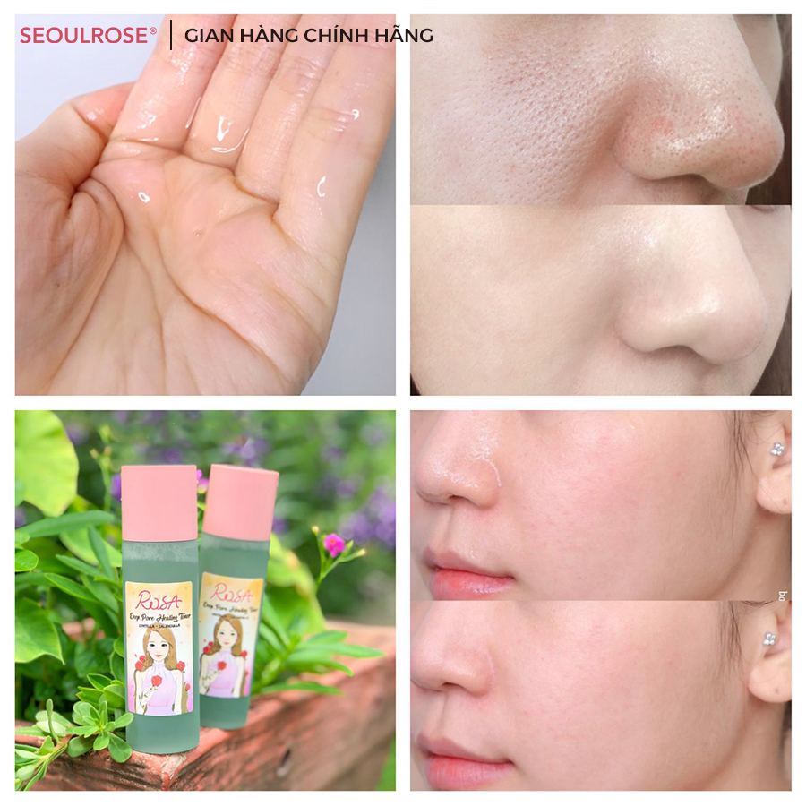 Nước Hoa Hồng SeoulRose Rosa Chiết Xuất Rau Má Và Hoa Cúc 120ml Date 2024