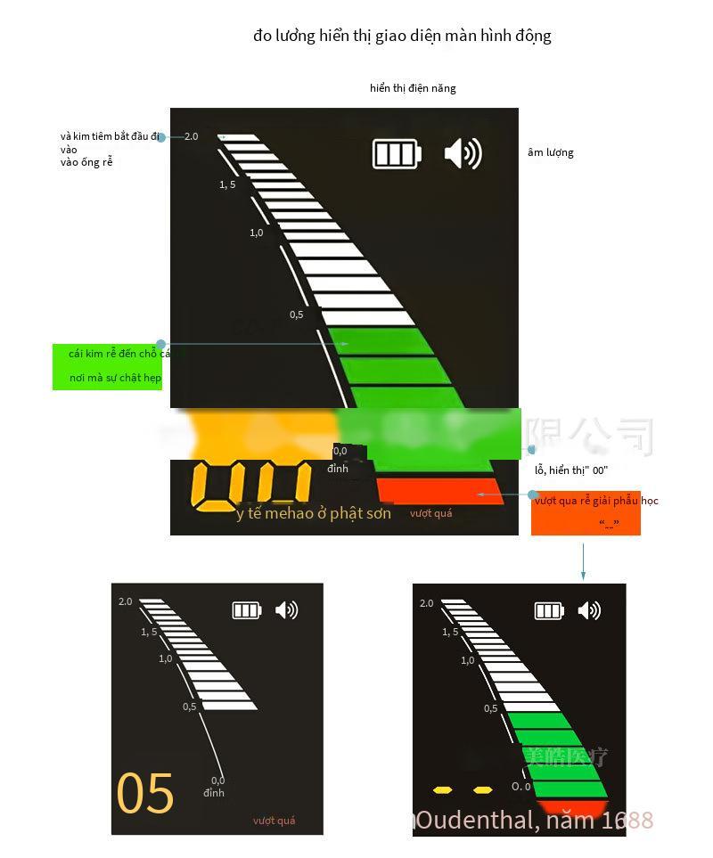 Khuyến mại nha khoa ống tủy đo chiều dài đầu chân răng đo bằng miệng giao diện USB LCD màn hình cảm ứng chân răng thước đo bút thử
