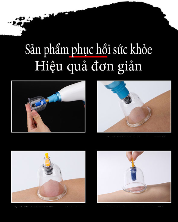 Bộ giác hơi chân không điện tử hút tự đông D977