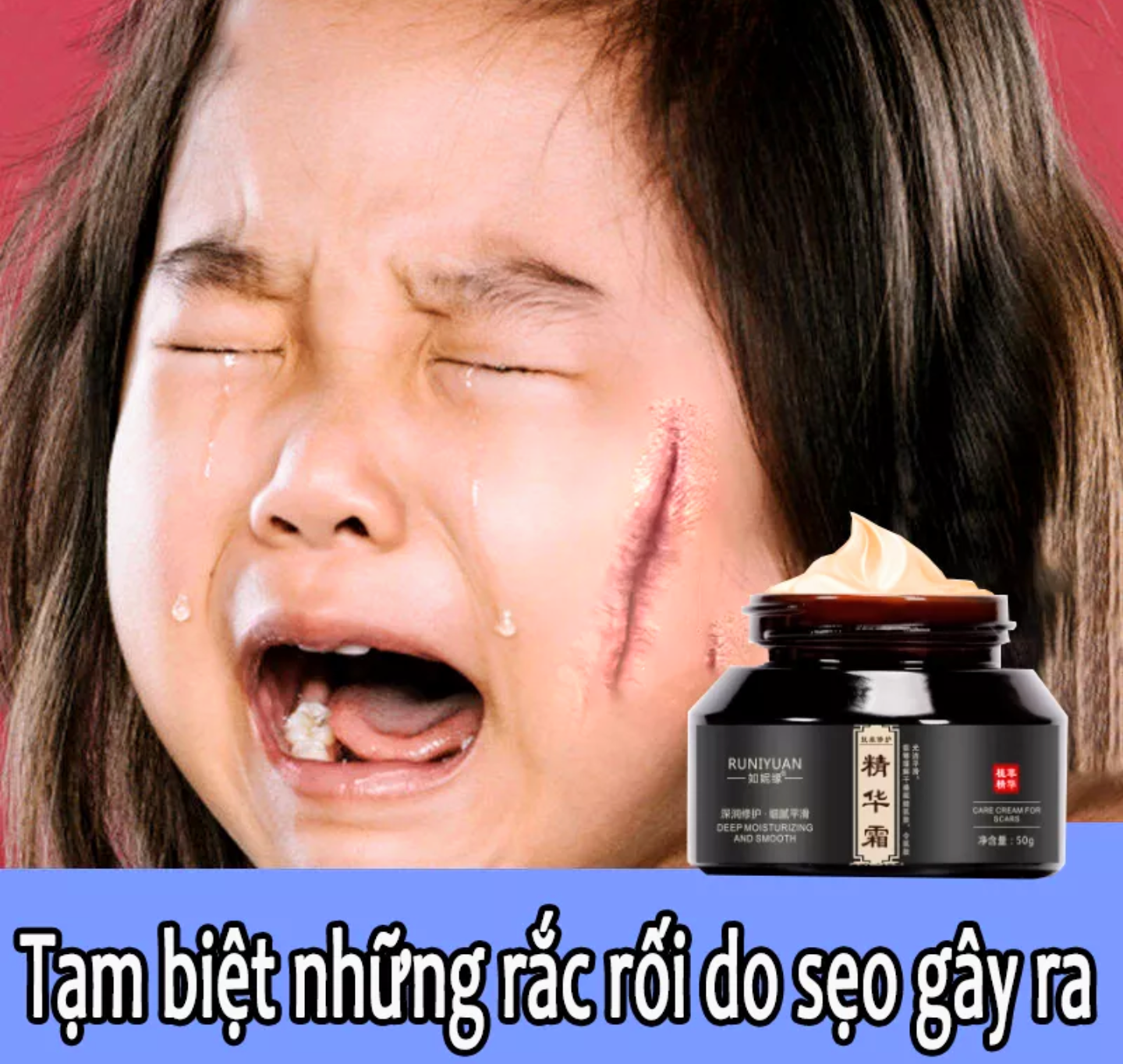 KEM TRỊ XÓA LÀM MỜ CÁC VẾT SẸO TRÊN DA HOÀN TOÀN NHANH CHÓNG HIỆU QUẢ CAO LOẠI TỐT NHẤT HIỆN NAY