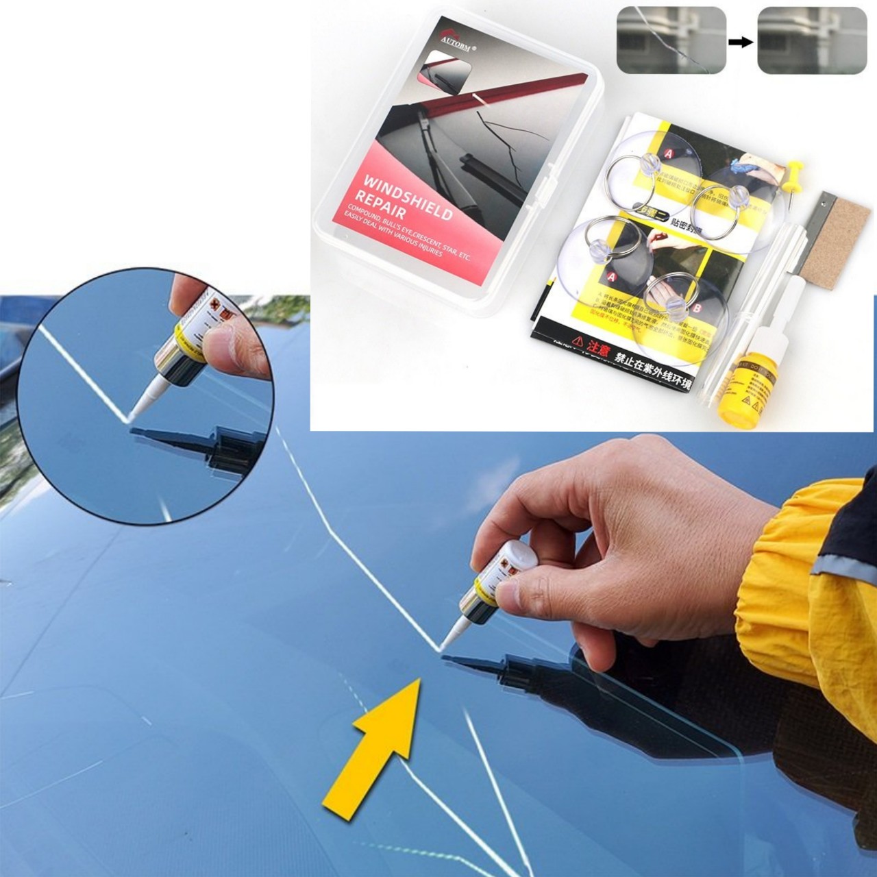 Bộ Keo Xử Lý phục hồi vết rạn nứt kính ô tô như mới A1 kèm phụ kiện loại tốt, keo gắn kính ô tô , cách phục hồi vết nứt vỡ kính ô tô