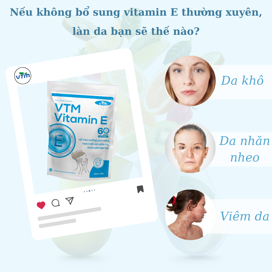 Viên uống bổ sung vitamin E VTM tăng cường sức khỏe, hỗ trợ chống oxy hóa, lão hóa da