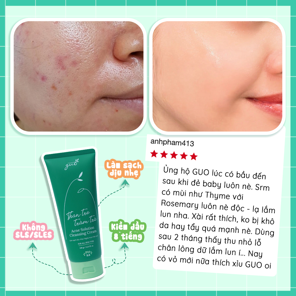 Sữa Rửa Mặt Than Tre Tràm Trà Kiềm Dầu Ngừa Mụn GUO - Acne Solution Cleansing Cream 100gr